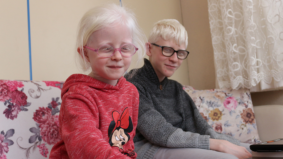 Albinizm hastası Hüseyin Ali azmiyle örnek oluyor