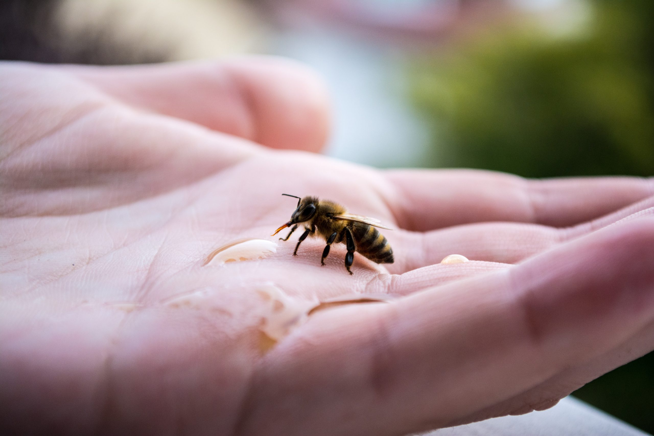 Arı sokması ciddi riskleri beraberinde mi getiriyor?