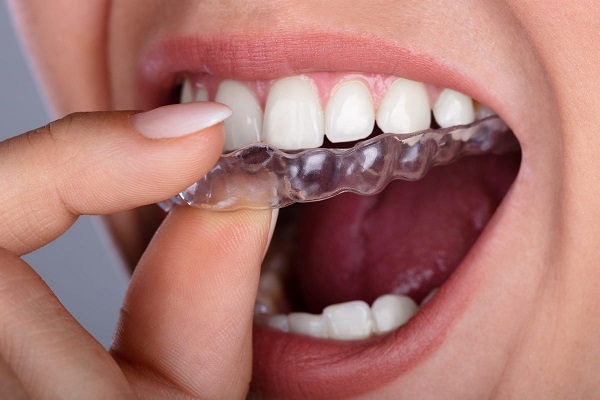 Diş sıkma gıcırdatma belirtileri nelerdir? 