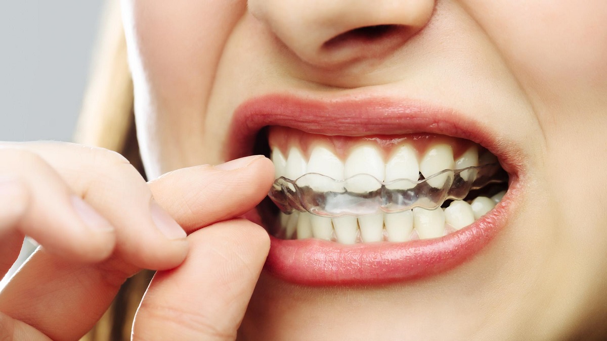 Gece plakları dişe zarar vermemesi için nasıl temizlenmeli?