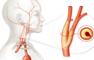 Rüyada Şah Damarı Görmek