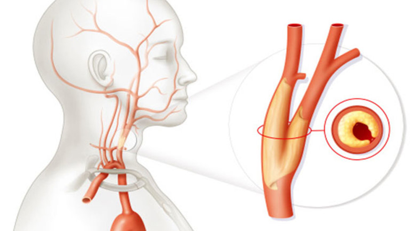 Rüyada Şah Damarı Görmek