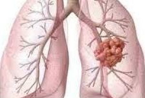 Rüyada Akciğer Görmek