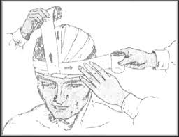 Rüyada Baş Sargısı Görmek