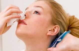 Rüyada Burun Kanı Görmek