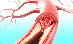 Rüyada Damar ve Sinirler Görmek