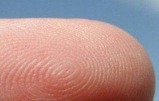 Rüyada Deri Yüzmek