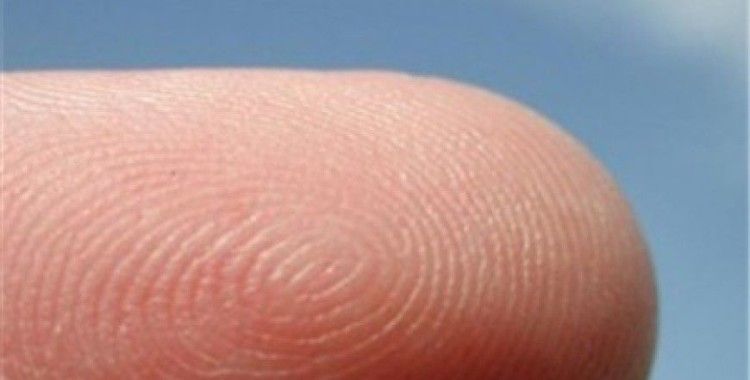 Rüyada Deri Yüzmek