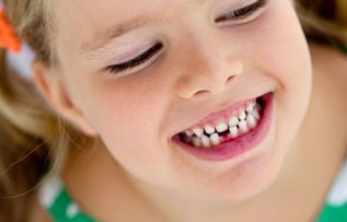 Rüyada Diş Dolgusunun Düşmesi