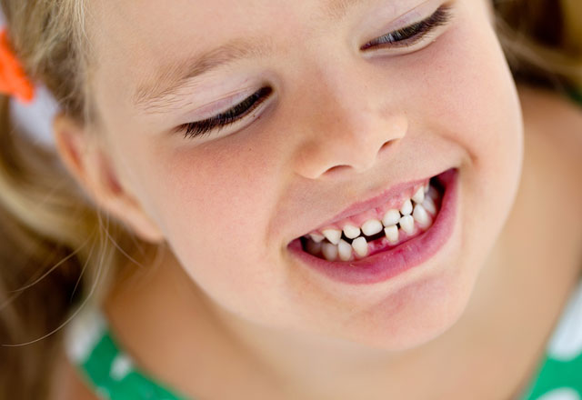 Rüyada Diş Dolgusunun Düşmesi