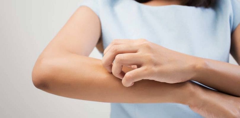 Rüyada Egzama Görmek