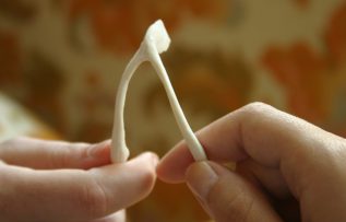 Rüyada Lades Kemiği Görmek