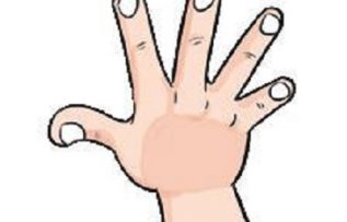 Rüyada Karışlamak