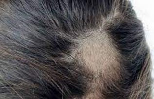 Rüyada Saçkıran Görmek