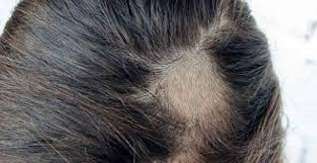 Rüyada Saçkıran Görmek