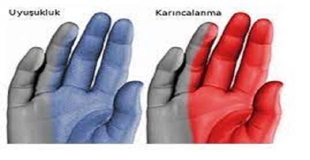 Rüyada Uyuşukluk Görmek