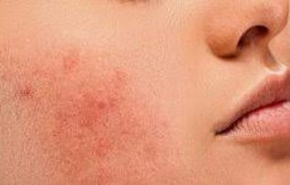 Rüyada Vücudunda Değişiklik Görmek