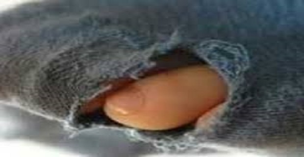 Rüyada Yırtık Görmek