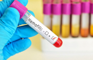 Yaşam boyu tedavi gerektiren Hemofilide farkındalık artıyor!