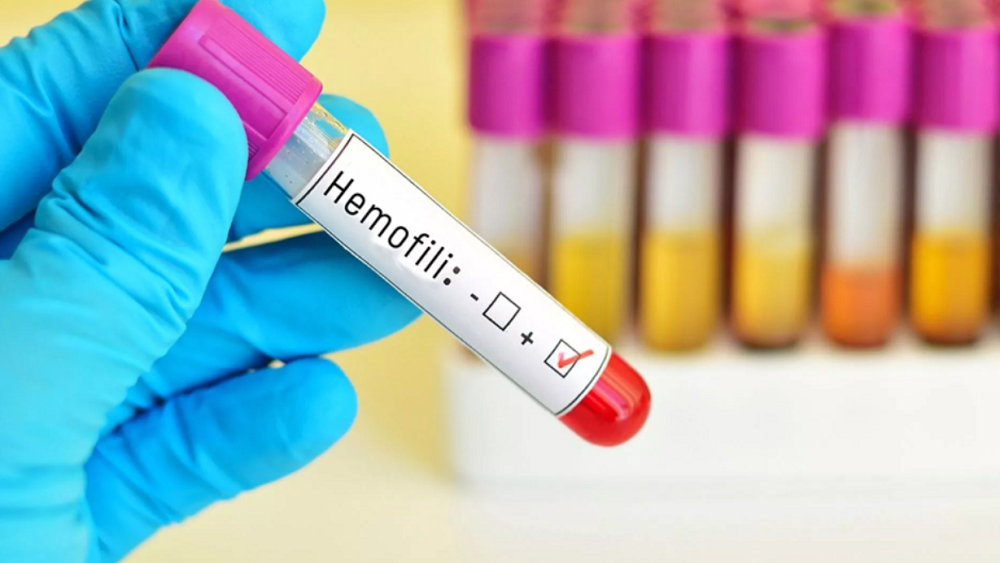 Yaşam boyu tedavi gerektiren Hemofilide farkındalık artıyor!