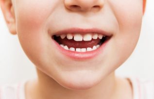 Çocukluk yaşlarında diş sorunlarına dikkat!